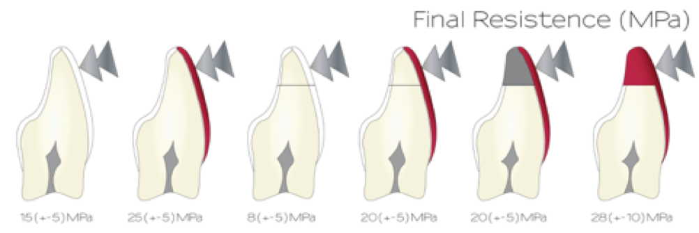 schema forza necessaria a provocare la fattura dentale