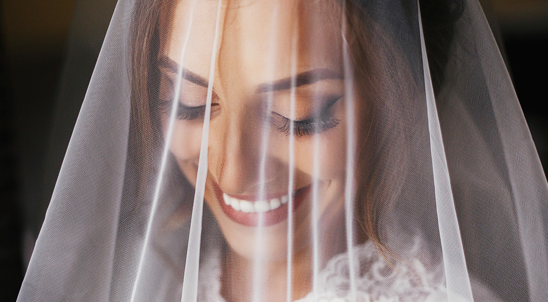 Faccette dentali