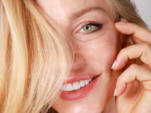 sorriso ottenuto con apparecchio linguale