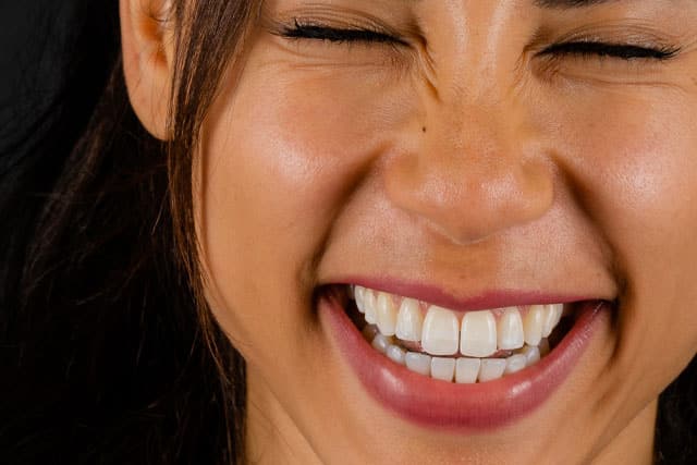 una giovane ragazza con un sorriso perfetto grazie al trattamento con le faccette dentali eseguito presso lo studio Vaccari